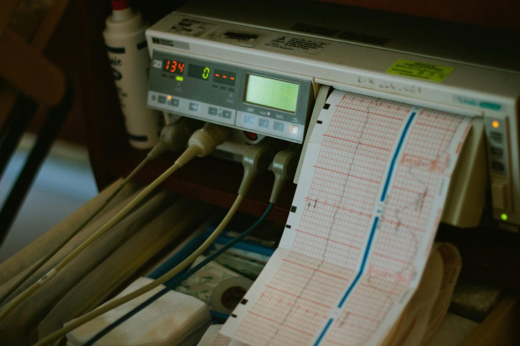 pexels-photo-263194-263194 Close-up of an ECG machine displaying heart rate results in a hospital setting.